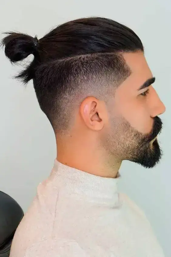 Disconnected Undercut - View 2